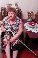 Екатерина Яровая нуждается в 65 тыс. гривен для срочной операции по замене коленного сустава